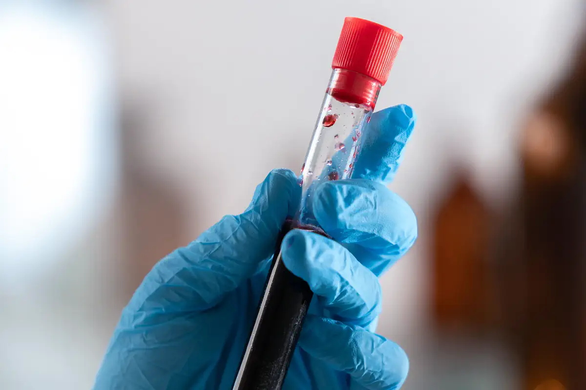 Gloved hand holding a blood sample tube in a laboratory