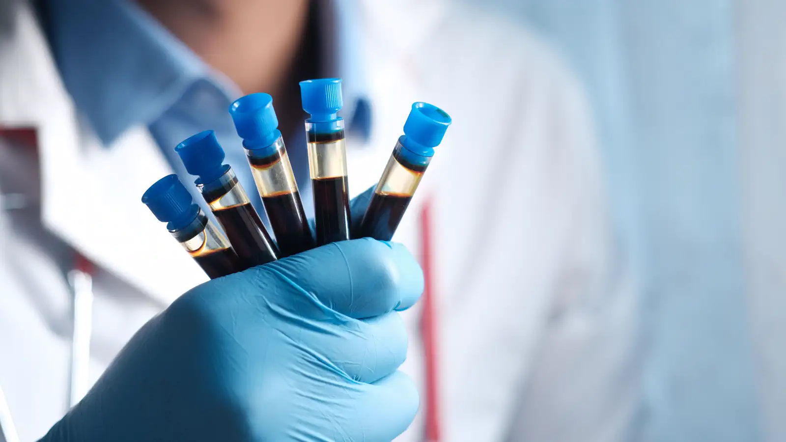 Creatinine vs. cystatin C: what each kidney test measures
